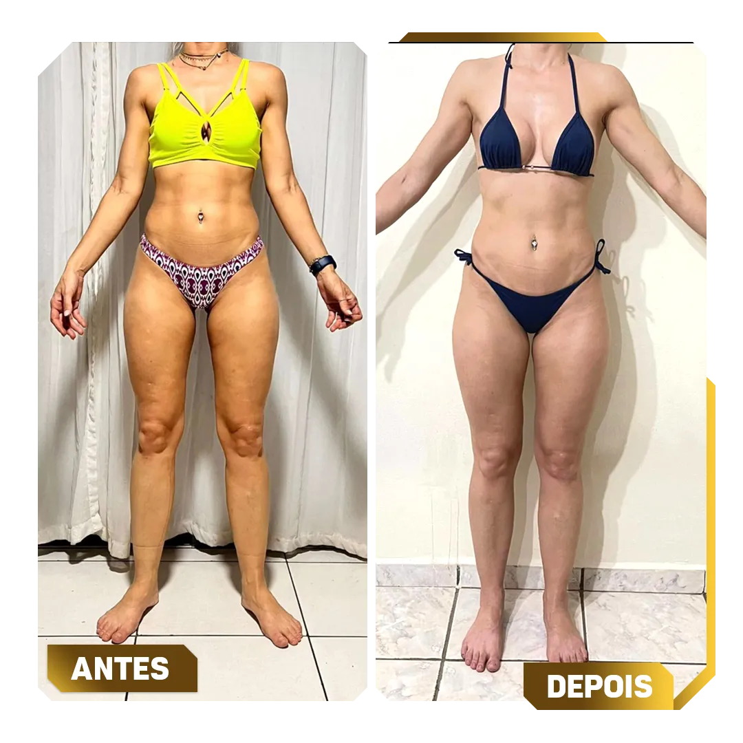 Template-Antes-e-Depois-3.webp