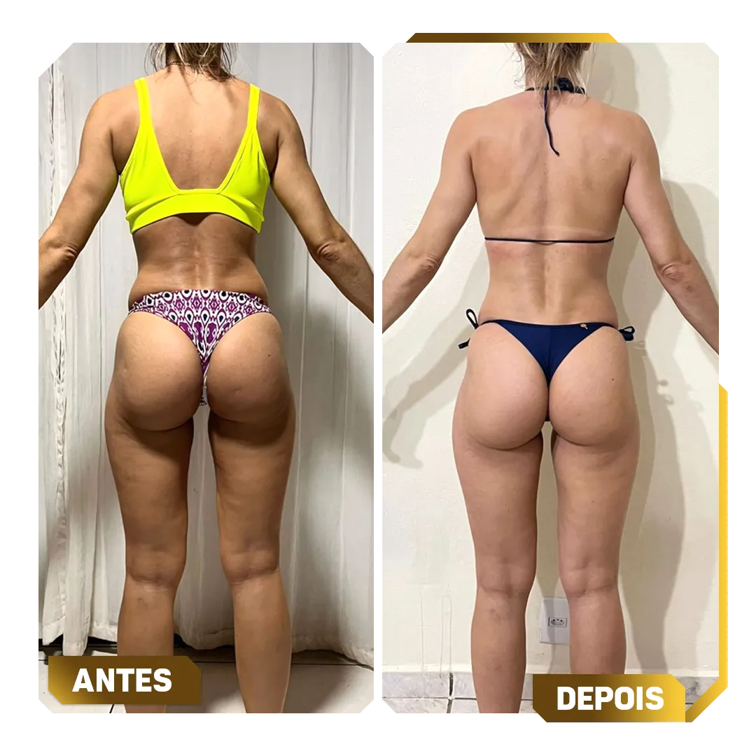 Template-Antes-e-Depois-5.webp