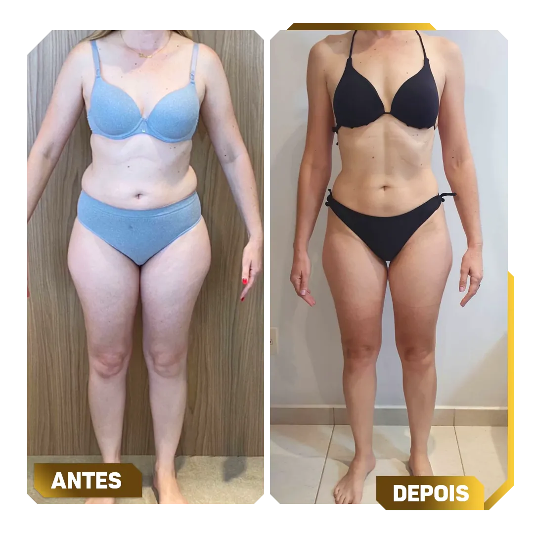 Template-Antes-e-Depois-6.webp