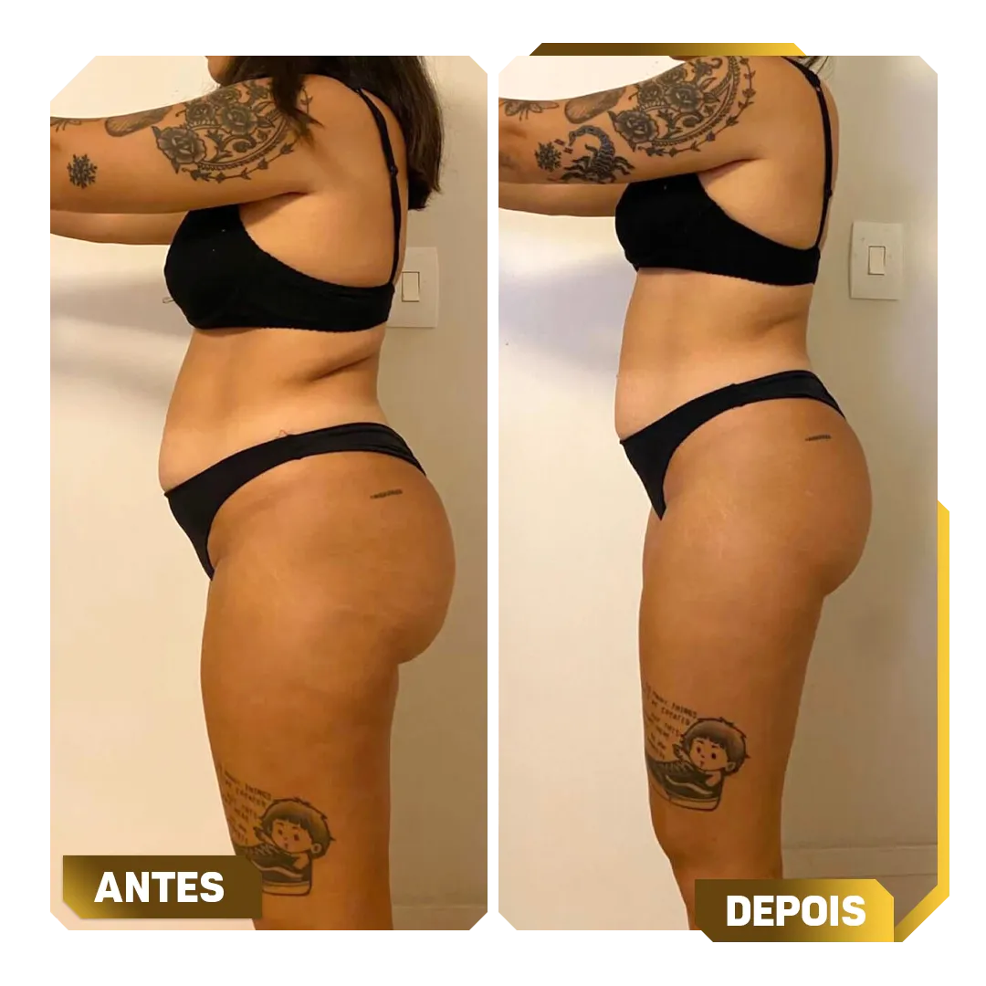 Template-Antes-e-Depois-9.webp